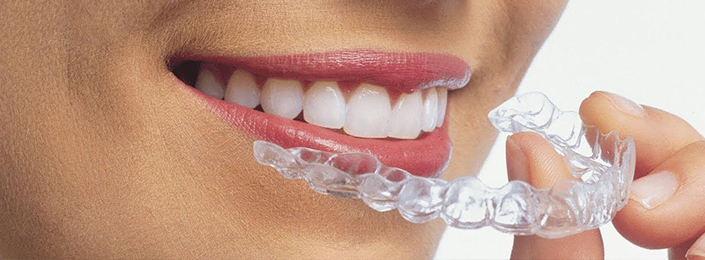 Diş Hekimi Engin Aksoy | Gece Plağı (Michigan Splint) Tedavisi