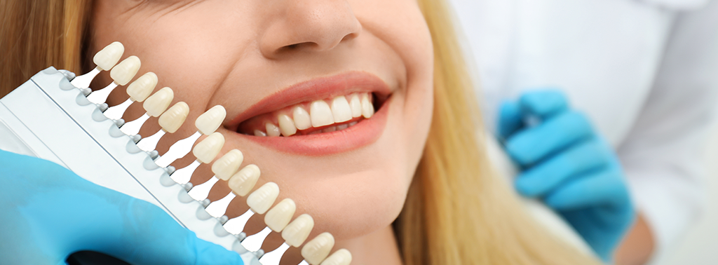 Diş Hekimi Engin Aksoy | Porselen Laminalar (Veneers)